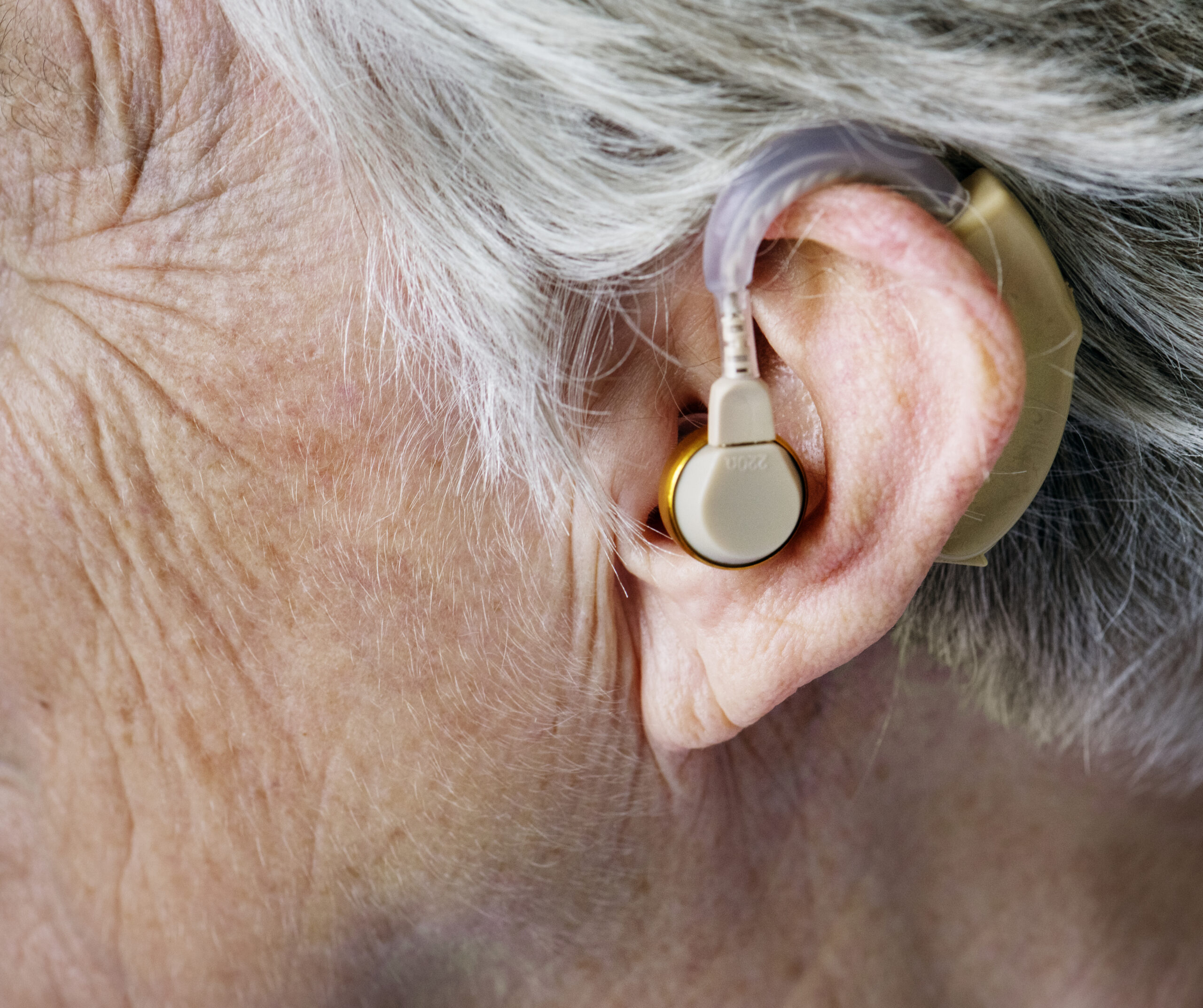 ndis consumable: hearing aid